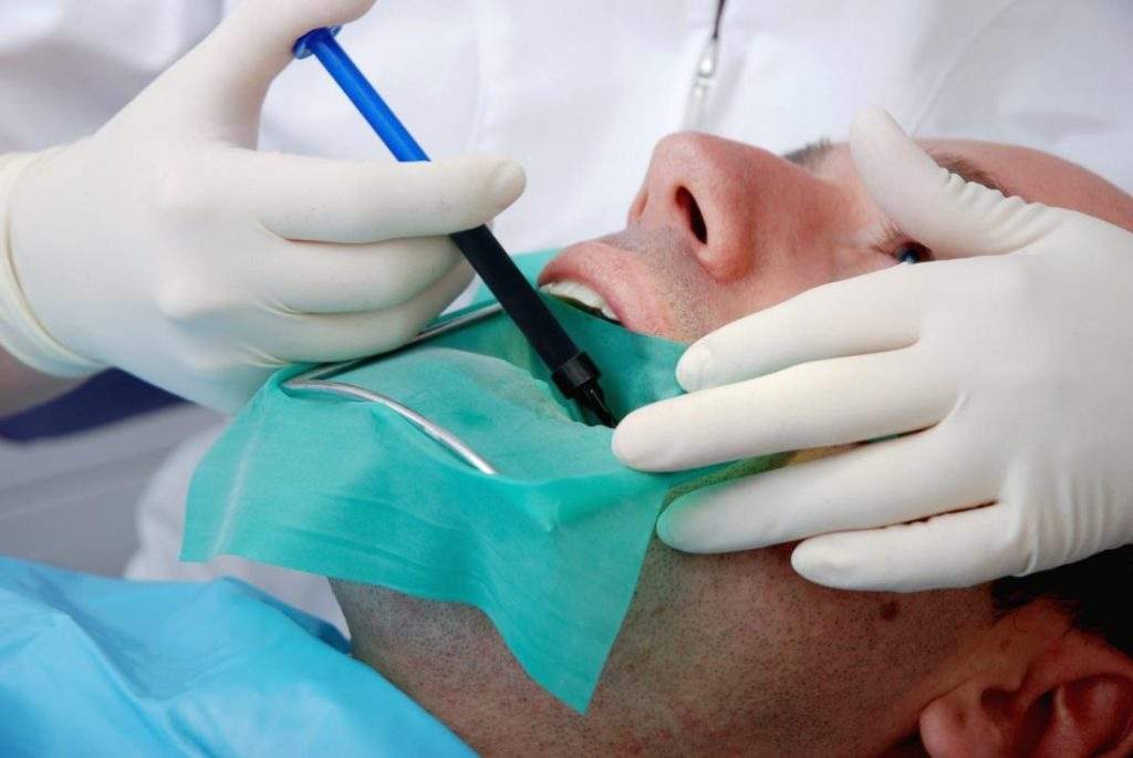 Define Root Canal Treatment Does It Cause Pain? Define Root Canal Treatment Does It Cause Pain?