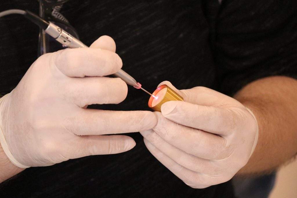 Laser Treatment