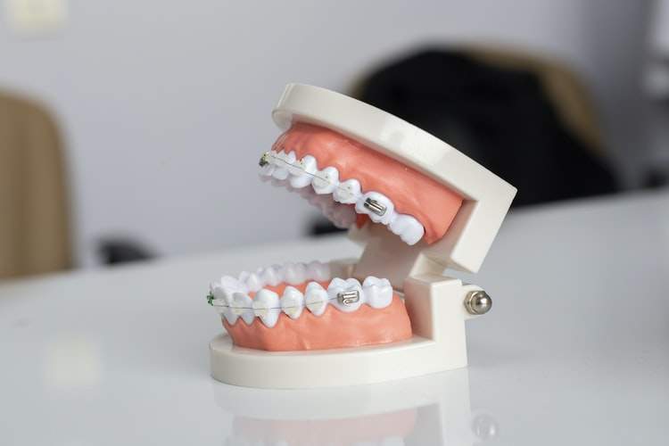 How Do Oral Surgeons and Orthodontists Differ?